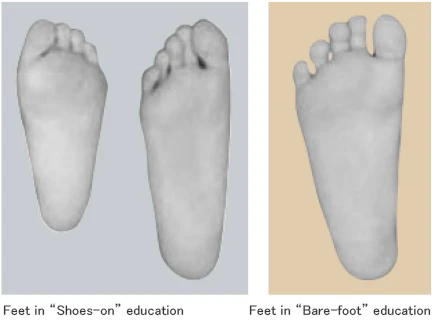 Shoes and socks will not allow toes to have enough room to stretch