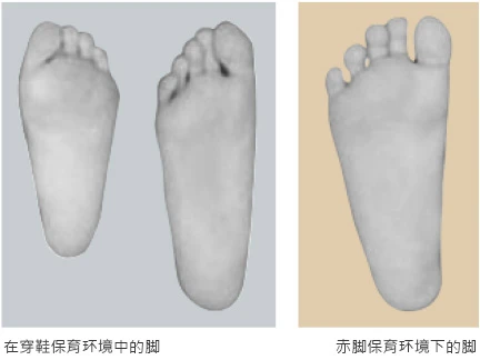 Shoes and socks will not allow toes to have enough room to stretch